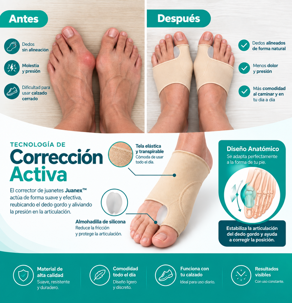 JuanexAlign™ | Realinee su juanete y recupere su vida.