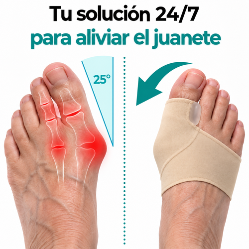 JuanexAlign™ | Realinee su juanete y recupere su vida.
