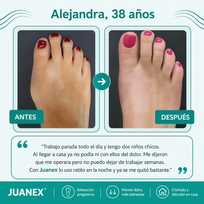 Juanex® | Corrector de Juanetes | ¡PRECIO ESPECIAL 50% OFF!!
