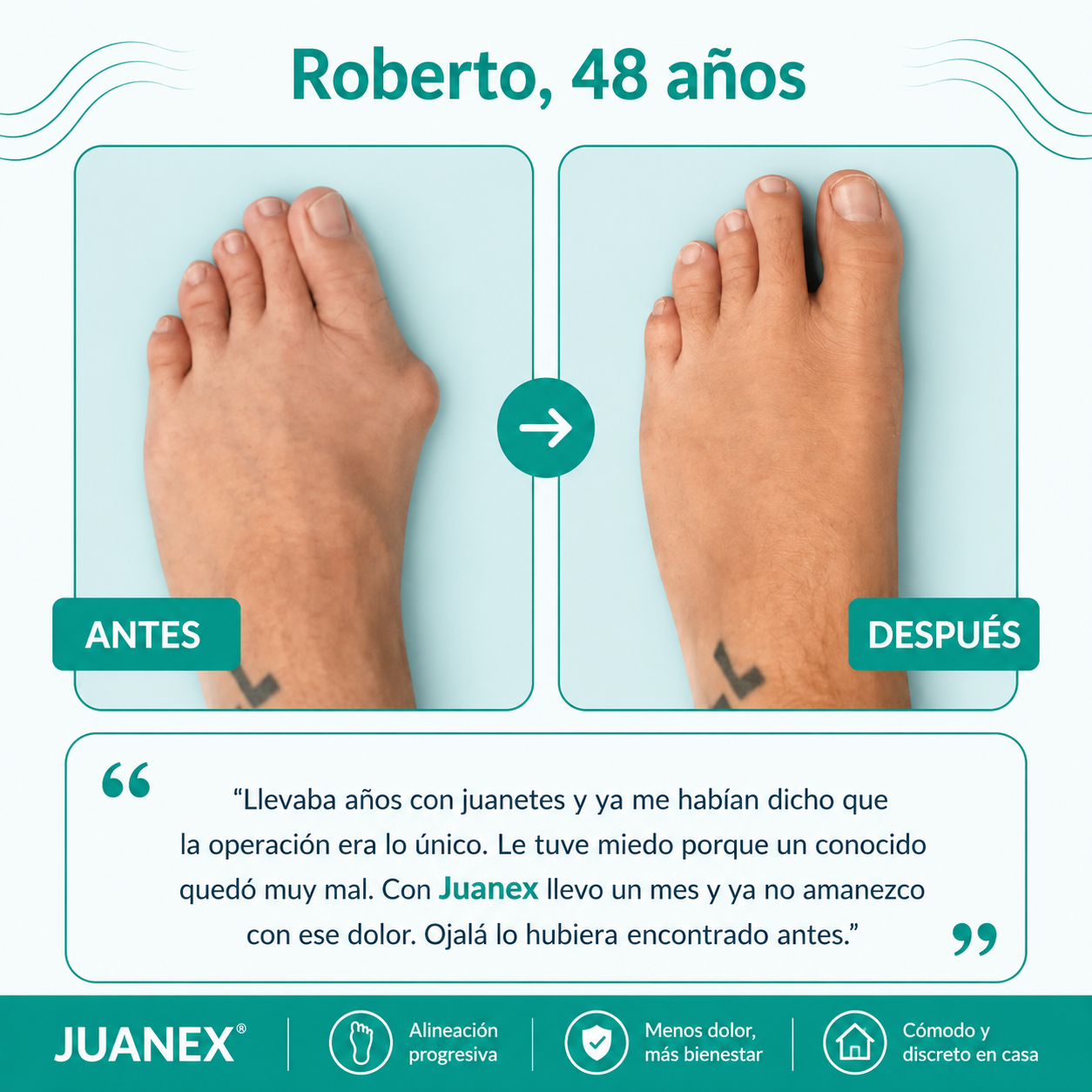 Juanex® | Corrector de Juanetes | ¡PRECIO ESPECIAL 50% OFF!!