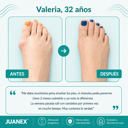Juanex® | Corrector de Juanetes | ¡PRECIO ESPECIAL 50% OFF!!