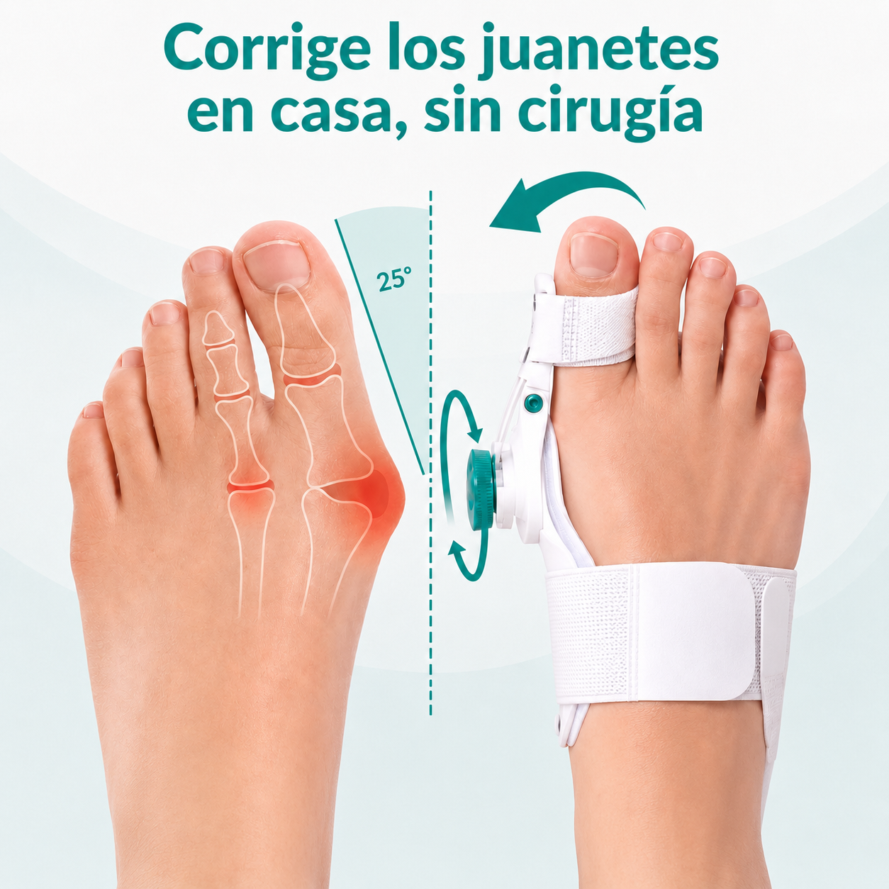 Juanex® | Corrector de Juanetes | ¡PRECIO ESPECIAL 50% OFF!!