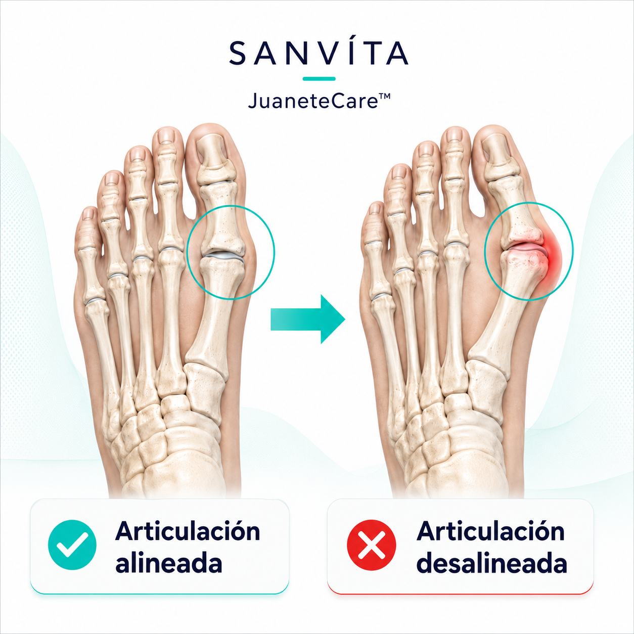 JuaneteCare® | Corrector de Juanetes | ¡ALIVIO Y CORRECCIÓN!